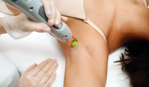 Epilation laser