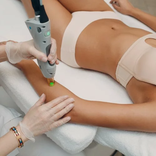 epilation laser bras