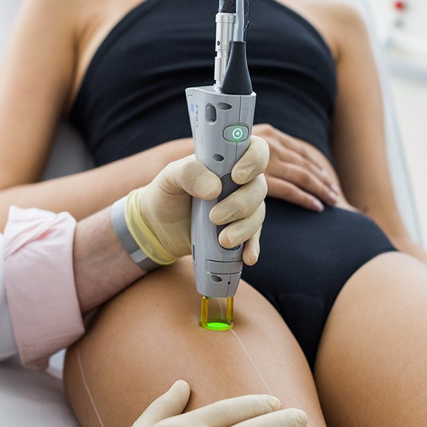 epilation laser cuisse