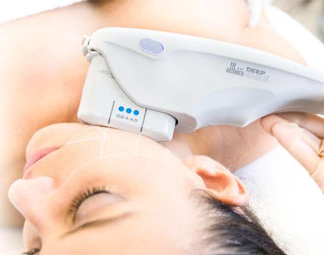 Ulthera® : Lifter sans chirurgie